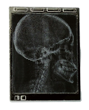 Lenticular X-Ray Light Box