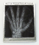 Lenticular X-Ray Light Box