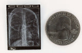 Lenticular X-Ray Light Box